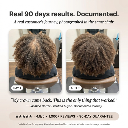 Roots & Co™ Hair Revival Ampoule (1.5 fl. oz)